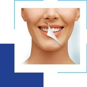 Tips on Choosing the Right Clinic for Teeth Whitening
